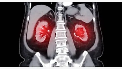 Alibaba Open-Sourced a CT Model That Scored 0.913 AUC Across 146 Abdominal Findings
