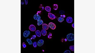 AI Wrote 302 Virus Genomes From Scratch. Sixteen of Them Came Alive.